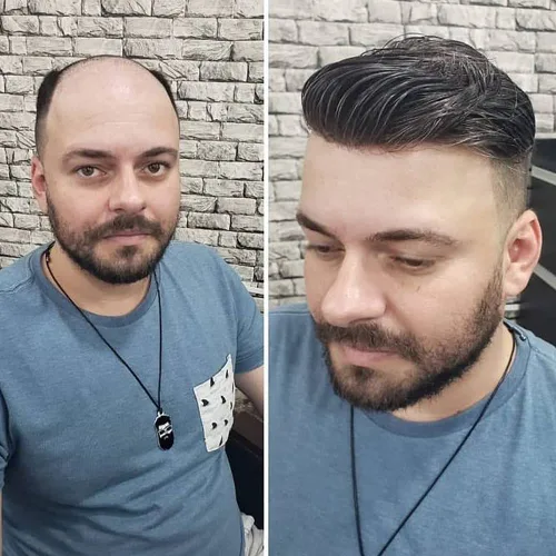 Miniatura 19 de SIMBEAUTY Cabello humano súper natural para hombre, estilo libre de tupé, 10 x 8 pulgadas, sistemas de reemplazo de cabello para hombres