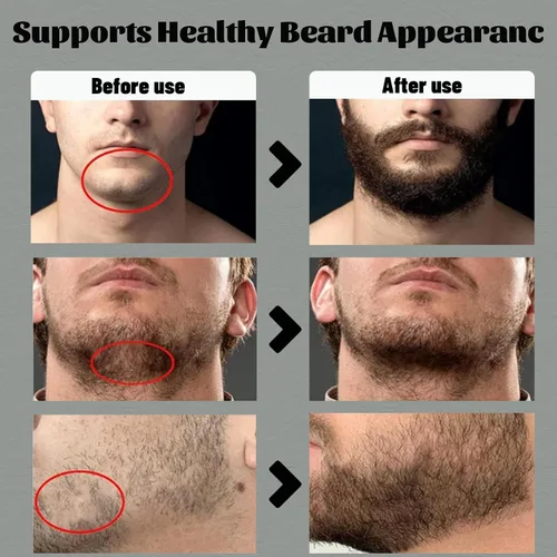 Miniatura 4 de Para Barba, Crecimiento De Barba Para Hombre, Bálsamo Estimulante de Barba Crema para Barba, Estimulante De Barba Ultra Potente, Bálsamo para Barba