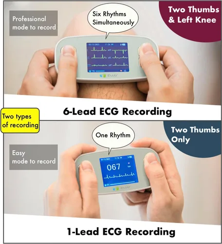 Miniatura 5 de EMAY 6L Monitor ECG portátil Graba ECG y frecuencia cardíaca en 6 canales Compatible con Smartphone y PC No se requiere suscripción