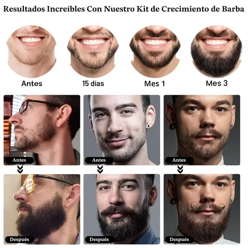 Miniatura 6 de RAFFIN Kit de crecimiento de barba, aceite para el crecimiento de la barba (2 onzas) con 3 biotinas espesantes y aceite de ricino para barba