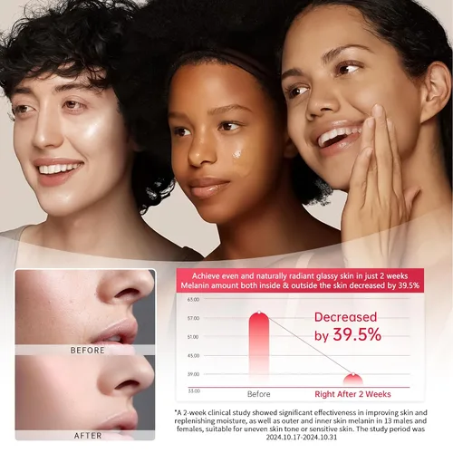 Miniatura 3 de Alpha Arbutin - Suero al 2% para manchas oscuras, cicatrices de acné, minimizador de poros, hidratación y eliminación de pigmentación, suero