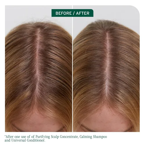 Miniatura 2 de Biolage Scalp Sync Calming Shampoo - Gently Cleanses Dry & Sensitive Scalps, Hydrates & Soothes, Fermented Tea Blend & Glycolic Acid, Vegan &
