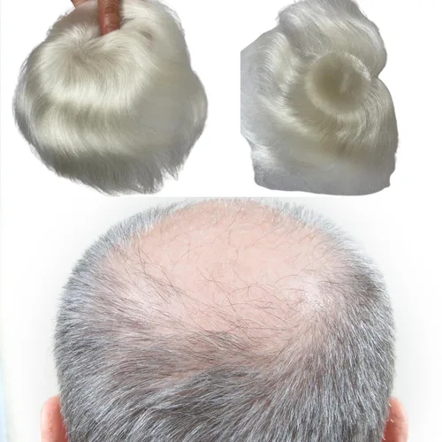 Miniatura 10 de Voloria Parche para el cabello calvo para hombres, 3.15 x 3.15 pulgadas, sistema de reemplazo de cobertura completa de piel de poliuretano