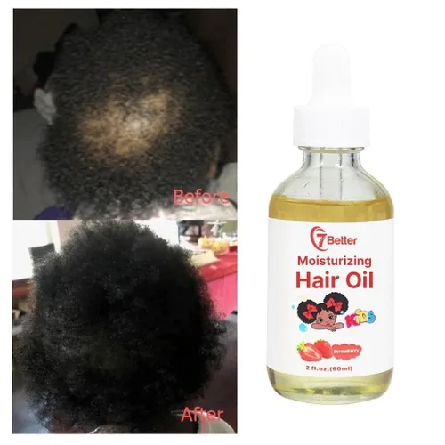 Miniatura 7 de Productos naturales para el cuidado del cabello para bebés, suero nutritivo y extra fuerte con aceite de semilla negra para un crecimiento potente