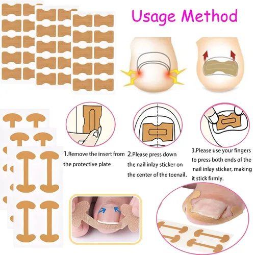 Miniatura 5 de Kit corrector de uñas encarnadas con tiras de corrección flexibles y cinta – Juego de herramientas profesionales de pedicura en el hogar