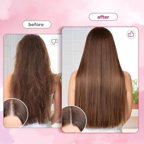 Miniatura 3 de SCOLA Gomitas para el cabello, la piel y las uñas, biotina (10,000 mcg) Suplemento vitamínico para el cabello, la piel y las uñas, para mujeres