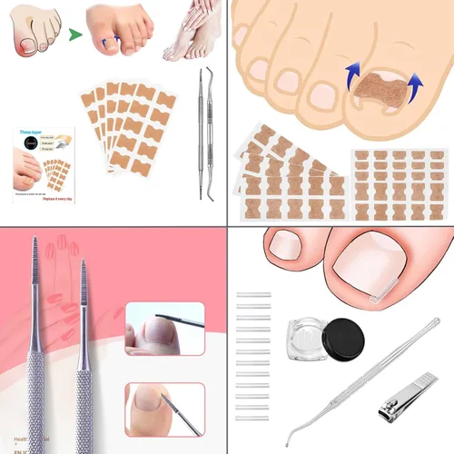 Miniatura 5 de Kit de tratamiento de uñas encarnadas – 16 piezas corrector profesional de uñas encarnadas con tiras, parches y almohadillas – Herramienta