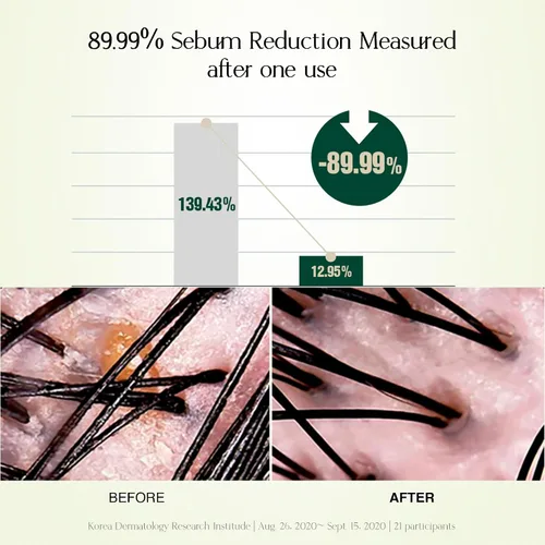 Miniatura 6 de Champú reequilibrante con solución de cuero cabelludo, limpieza refrescante y refrescante para cuero cabelludo normal a graso, dermatológicamente