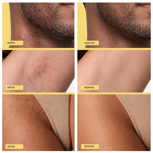 Miniatura 3 de Base Laboratories Tratamiento para el cabello encarnado – Suero Roller – Suero para suavizar la piel para pelos encarnados y protuberancias