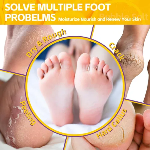 Miniatura 2 de Remojo de pies de pedicura, baño de pies de spa, kit de pedicura, baño de pies de burbujas para pies agrietados y cansados y secos, pies de atletas