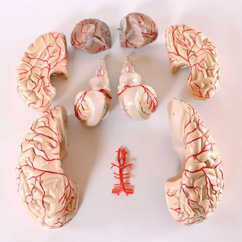 Miniatura 2 de Wellden Modelo anatómico de cerebro, de 9 partes, con arterias, tamaño real.