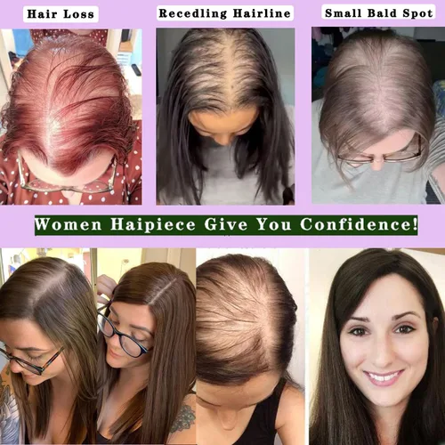 Miniatura 5 de Voloria Toppers de cabello humano real de 12 pulgadas para mujer, densidad media, base de poliuretano completa, extensiones de cabello