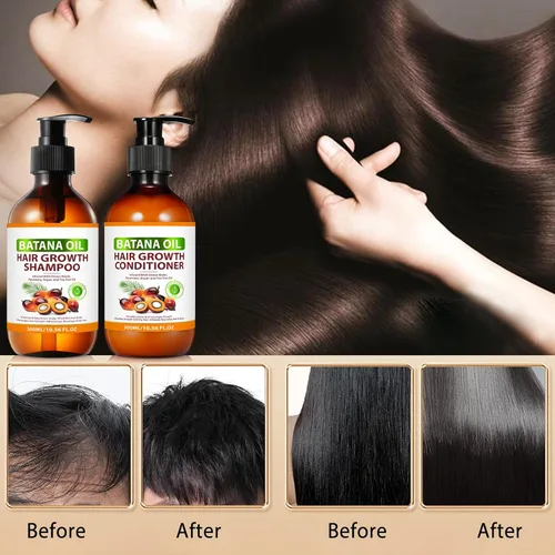 Miniatura 9 de Batana Oil - Juego de champú y acondicionador orgánico Batana con cebolla, romero, árbol de té de argán, productos para el cabello espesante