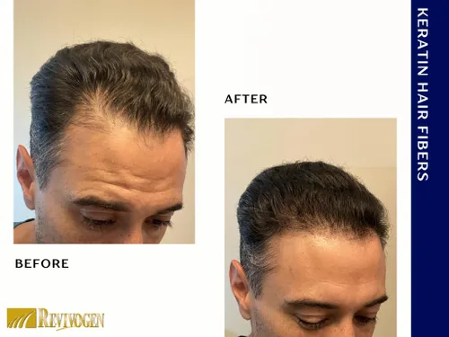 Miniatura 7 de RevivogenMD - Fibras de queratina para el cabello, color negro, sin perfume, 0.9 onzas