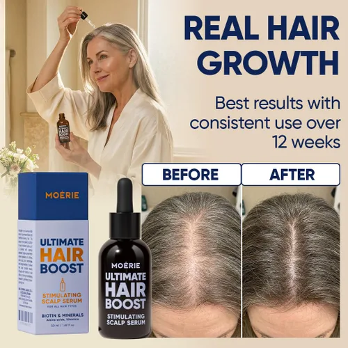 Miniatura 4 de Moerie Suero para el Crecimiento del Cabello Ultimate para el Crecimiento Natural del Cabello y Engrosamiento - Tratamiento Anti Adelgazamiento