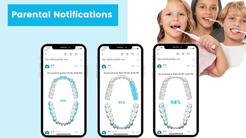 Miniatura 6 de Blu Cepillo de dientes inteligente para niños de hasta 8 años, cepillo de dientes sónico habilitado para aplicaciones con seguimiento en vivo, ayuda