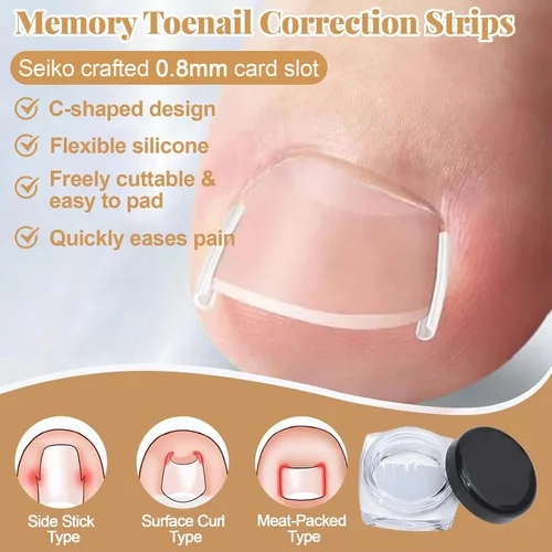Miniatura 5 de Kit de eliminación y corrector de uñas encarnadas para un alivio rápido del dolor, kit profesional de tratamiento de uñas encarnadas con tiras