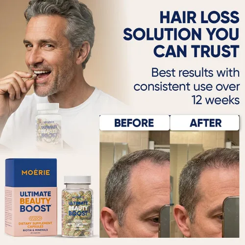 Miniatura 4 de Moerie Suplementos definitivos para el crecimiento del cabello para mujeres y hombres, para cabello, piel, uñas, vitaminas con biotina y minerales