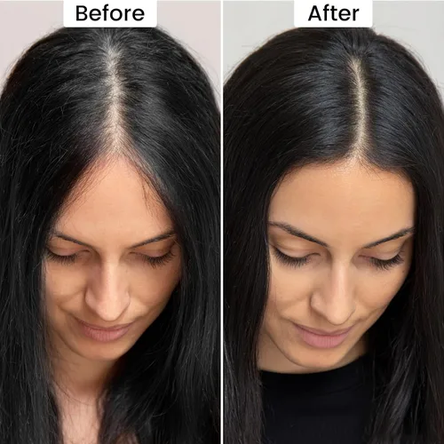 Miniatura 5 de Polvo de retoque de raíz, polvo instantáneo para la línea del cabello para áreas delgadas y cobertura de cabello gris, cobertura de raíz natural
