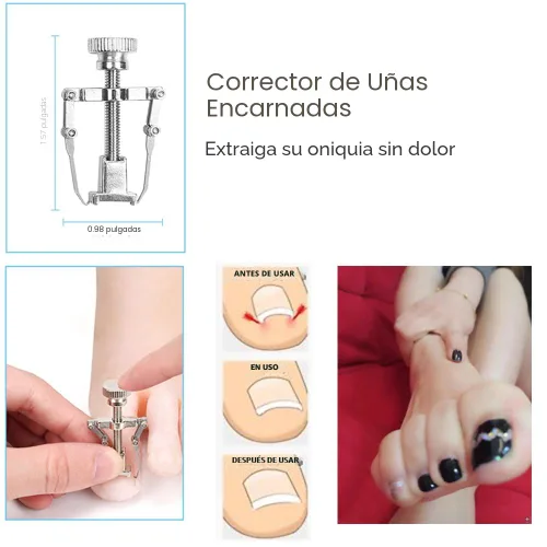 Miniatura 6 de Bcabo Kit de herramientas de uñas encarnadas, herramienta de pie de tratamiento de uñas, cortaúñas encarnadas, cortaúñas encarnadas, levantador