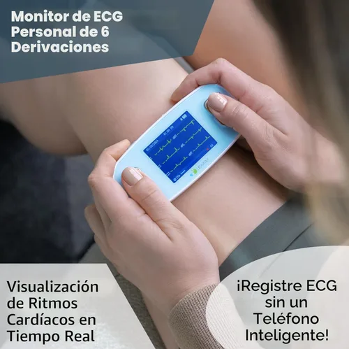 Miniatura 2 de EMAY 6L Monitor ECG portátil Graba ECG y frecuencia cardíaca en 6 canales Compatible con Smartphone y PC No se requiere suscripción
