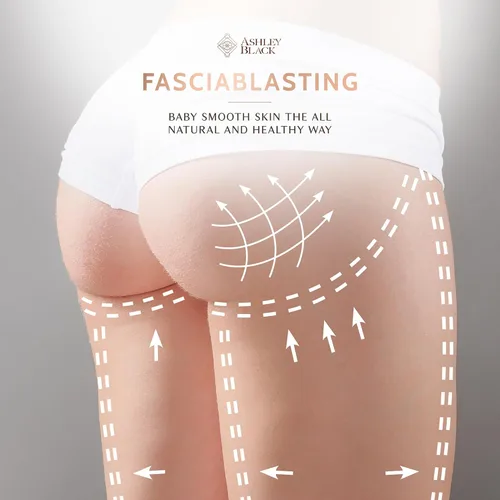 Miniatura 8 de Fasciablaster