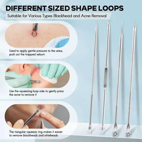 Miniatura 3 de FEITA Kit de herramientas para eliminar puntos negros, extractor de espinillas de comedón, herramientas de acné para nariz facial, aguja de acné