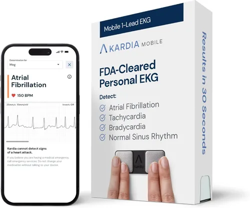 KardiaMobile Monitor de electrocardiograma de 1 derivación, monitor cardíaco personal aprobado por la FDA de grado médico, detecta normal, AFib y