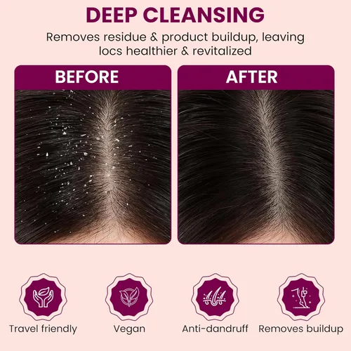 Miniatura 6 de Rastta Locs Organic Loc - Barra de champú con acondicionadores hechos para rastas, trenzas, rastas. Elimina la acumulación y los residuos