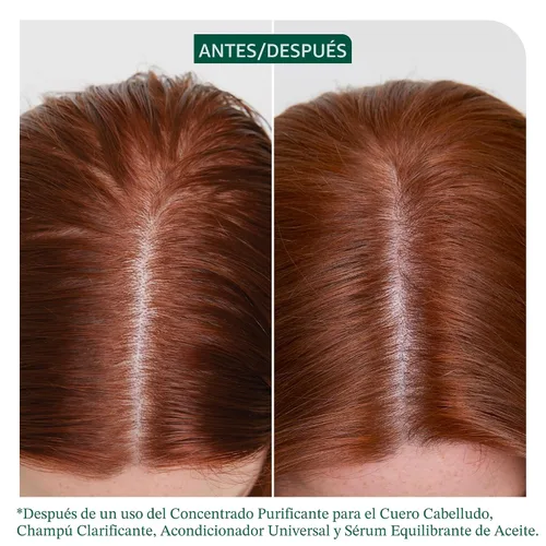 Miniatura 2 de Biolage Scalp Sync Clarifying Shampoo - Residue & Buildup Remover, For Oily Scalp
