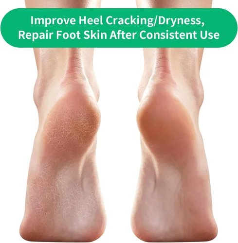 Miniatura 5 de Ohtomber 5 pares de calcetines de reparación de tratamiento de talón agrietado - Ohtomber 5 pares de gel de silicona para el cuidado de los pies