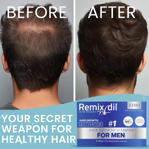 Miniatura 7 de Vitaminas para el crecimiento del cabello para hombres Apoya la fuerza de la barba y el cuero cabelludo Ayuda a reducir el adelgazamiento