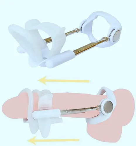 Miniatura 5 de Dispositivos de tracción de pene para hombres, kit de masaje, barra extensora, tamaño masculino, estirador de entrenamiento de resistencia