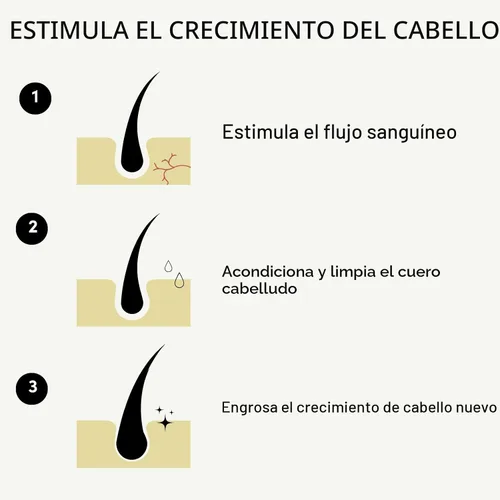 Miniatura 3 de Forest & Shore Aceite para el crecimiento del cabello, 100% natural, con cafeína, biotina, ricino, argán y romero, suero eficaz para cabello dañado