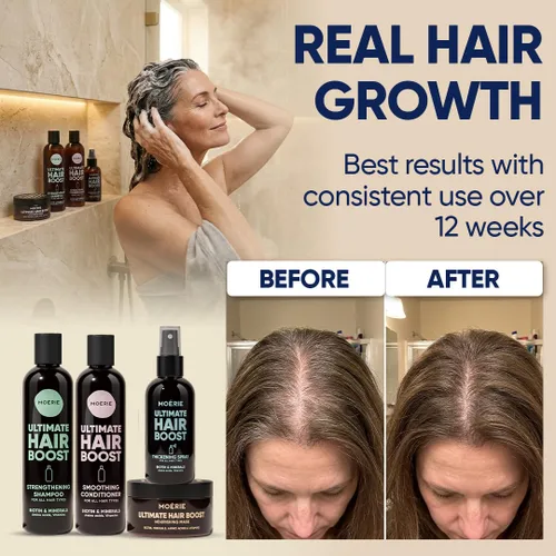 Miniatura 4 de Moérie Champú para el crecimiento del cabello, acondicionador, spray y máscara para hombres y mujeres, solución de pérdida de cabello con biotina