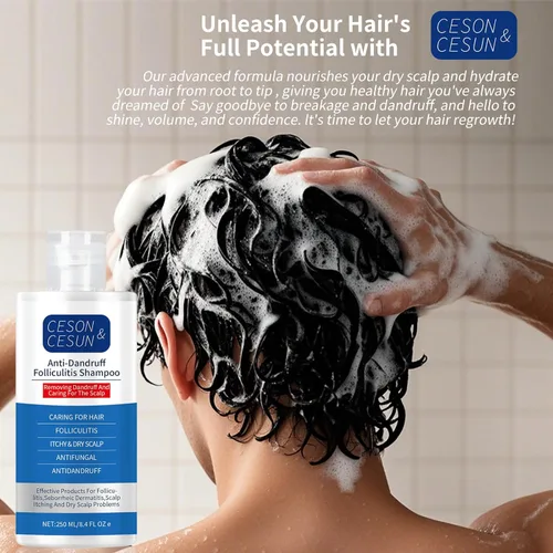 Miniatura 12 de Ceson&Cesun Champú 2 en 1 antifúngico/anticaspa para foliculitis, psoriasis del cuero cabelludo y dermatitis seborreica, alivio de la picazón