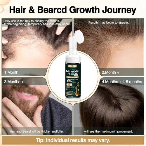 Miniatura 5 de 5% de espuma de minoxidil para hombres y mujeres, ralentiza la pérdida de cabello y promueve el tratamiento de crecimiento del cabello para mujeres