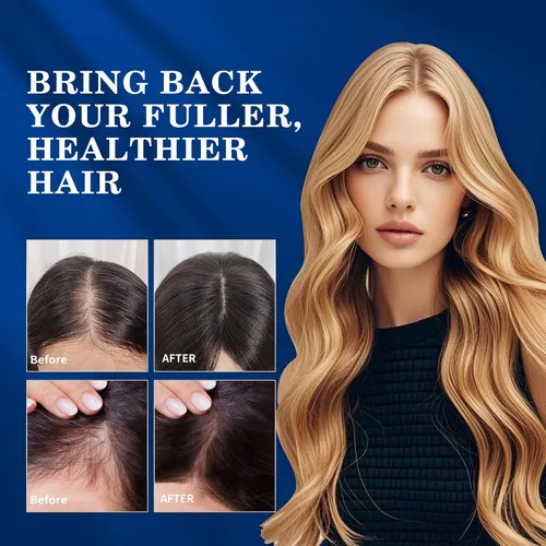 Miniatura 4 de Kit de spray para crecimiento del cabello de minoxidil al 5 % para hombres y mujeres: solución tópica para recrecimiento para barba, suero