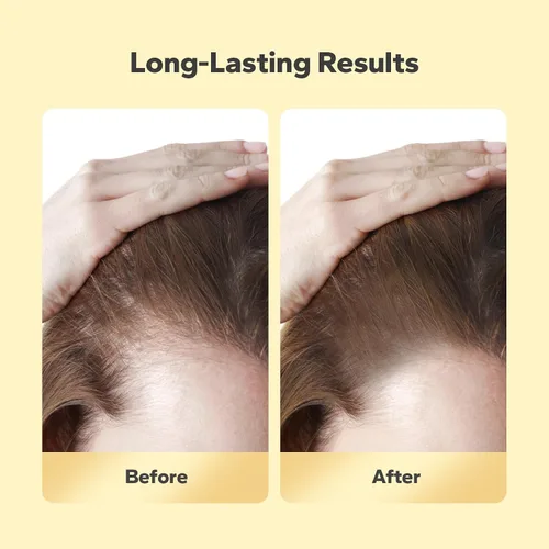 Miniatura 6 de Polvo de línea capilar – a prueba de manchas para cabello fino, color a prueba de sudor para mujeres y hombres (marrón oscuro)