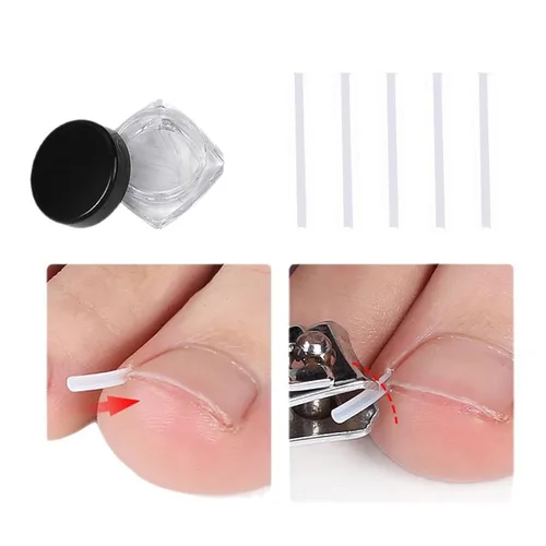 Miniatura 6 de Juego profesional de uñas encarnadas con tiras transpirables de uñas encarnadas, tiras correctoras de uñas de los pies, parche corrector de uñas