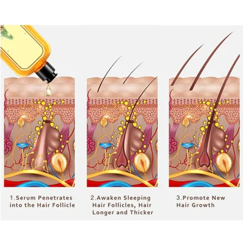 Miniatura 3 de Champú instantáneo de jengibre para el crecimiento del cabello y la pérdida de cabello, 17.6 onzas líquidas (paquete de 1)