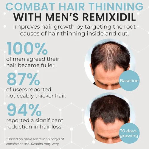 Miniatura 3 de Vitaminas para el crecimiento del cabello para hombres Apoya la fuerza de la barba y el cuero cabelludo Ayuda a reducir el adelgazamiento