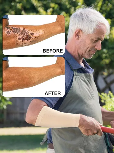 Miniatura 2 de Janmercy 9 pares de protectores de brazo para piel fina y moretones protectores de brazos para ancianos para trabajo de jardinero