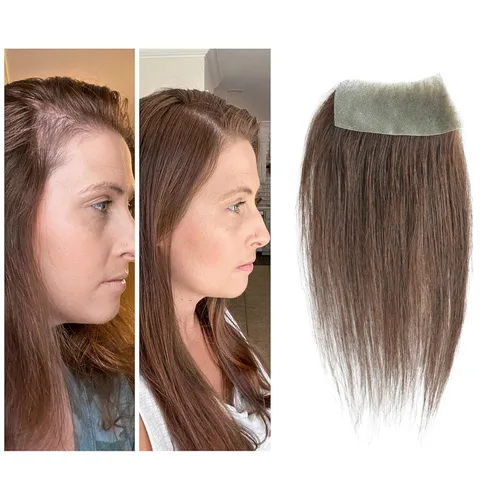 Miniatura 48 de Reemplazo de cabello humano con cicatrices, quemaduras accidentales sin vello para hombres y mujeres, pérdida de línea de cabello, cinta recta