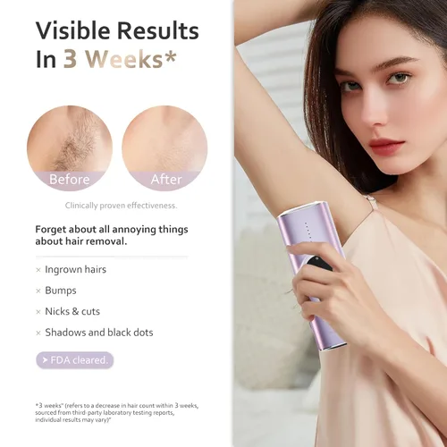 Miniatura 2 de BeautyGlow Dispositivo de depilación láser para mujeres, removedor de pelo IPL en casa con tecnología de enfriamiento de hielo para cara y cuerpo