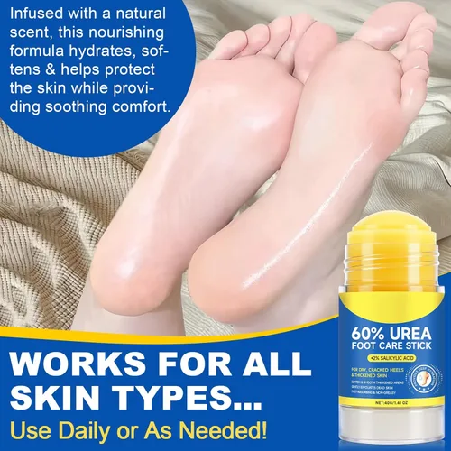 Miniatura 8 de Crema en barra de urea 60% más 2% ácido salicílico, crema de urea para pies y callos de máxima fuerza para talones secos agrietados, manos