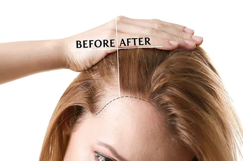 Miniatura 6 de Mezcla para el crecimiento del cabello con agua de arroz, 100% natural, extra fuerte, niebla de hierbas, aerosol, acondicionador para el cuero