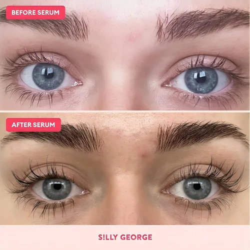 Miniatura 6 de Silly George Suero de crecimiento de pestañas para cejas más gruesas, más llenas, más largas y atrevidas, suero premium, potenciador de pestañas