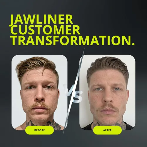 Miniatura 10 de Jawliner® - Pioneros de la goma de mandíbula artesanal más resistente 15 veces más dura, incluye 12 semanas de entrenamiento - Goma dura de menta