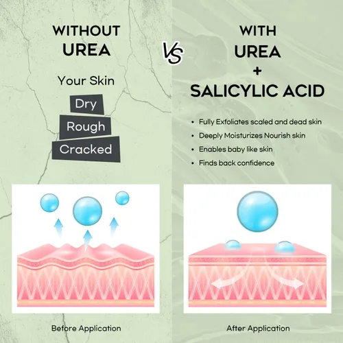 Miniatura 4 de Crema de urea 42% para pies, ácido salicílico, 4 onzas, removedor de callos mejorado para pies, rodillas y codos, hidrata y suaviza la piel, exfolia